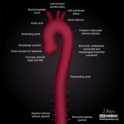 Descending Aorta